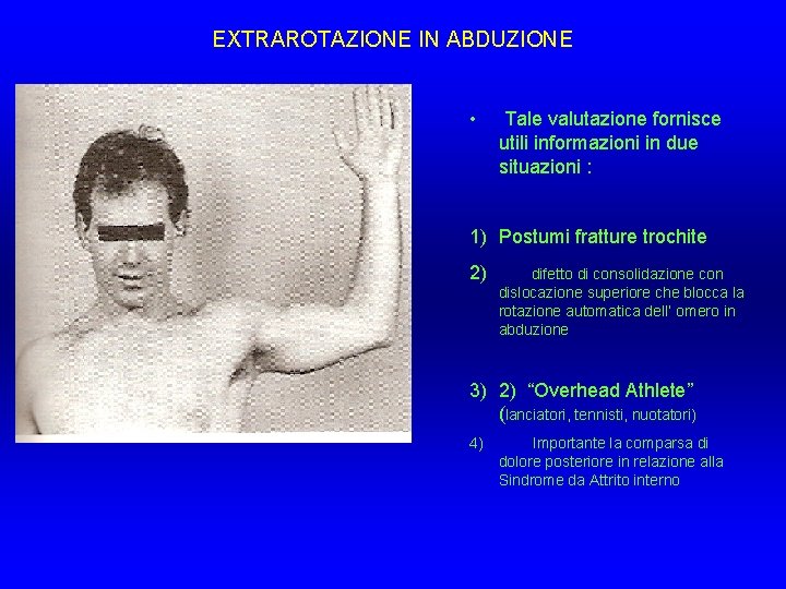 EXTRAROTAZIONE IN ABDUZIONE • Tale valutazione fornisce utili informazioni in due situazioni : 1) EXTRAROTAZIONE IN ABDUZIONE • Tale valutazione fornisce utili informazioni in due situazioni : 1)