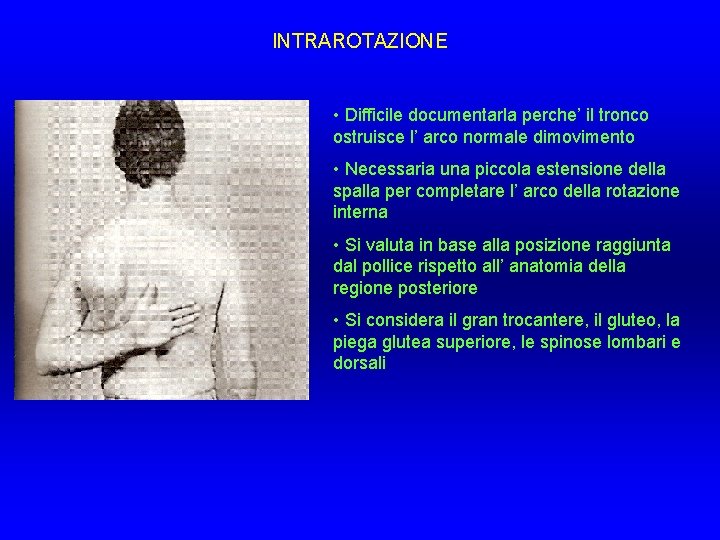 INTRAROTAZIONE • Difficile documentarla perche’ il tronco ostruisce l’ arco normale dimovimento • Necessaria INTRAROTAZIONE • Difficile documentarla perche’ il tronco ostruisce l’ arco normale dimovimento • Necessaria