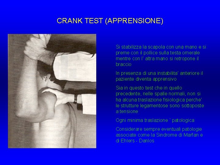 CRANK TEST (APPRENSIONE) Si stabilizza la scapola con una mano e si preme con CRANK TEST (APPRENSIONE) Si stabilizza la scapola con una mano e si preme con