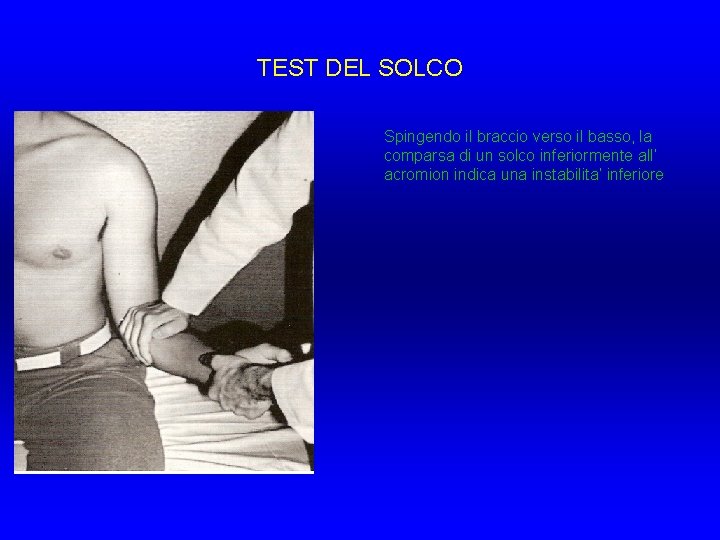 TEST DEL SOLCO Spingendo il braccio verso il basso, la comparsa di un solco TEST DEL SOLCO Spingendo il braccio verso il basso, la comparsa di un solco