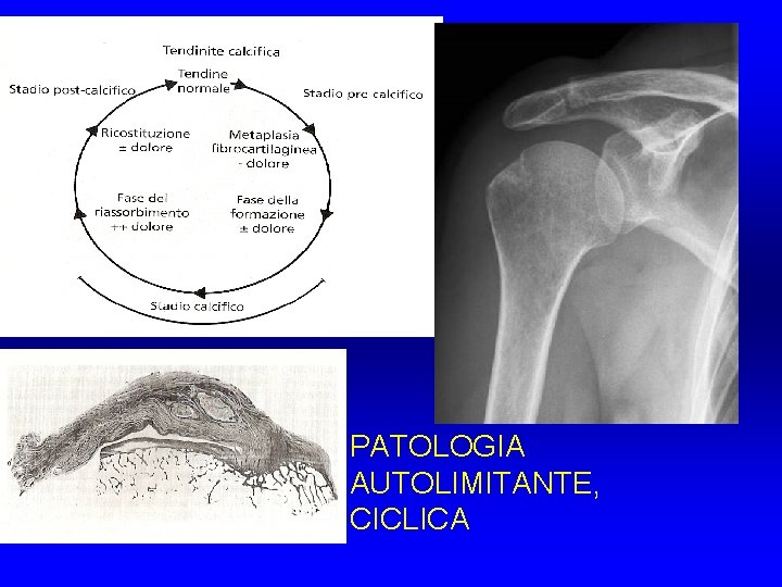 PATOLOGIA AUTOLIMITANTE, CICLICA PATOLOGIA AUTOLIMITANTE, CICLICA