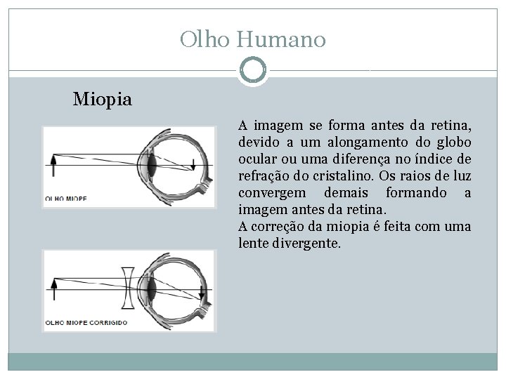 Olho Humano Miopia A imagem se forma antes da retina, devido a um alongamento