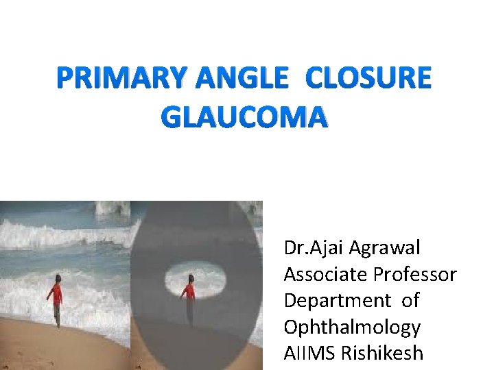 PRIMARY ANGLE CLOSURE GLAUCOMA Dr. Ajai Agrawal Associate Professor Department of Ophthalmology AIIMS Rishikesh