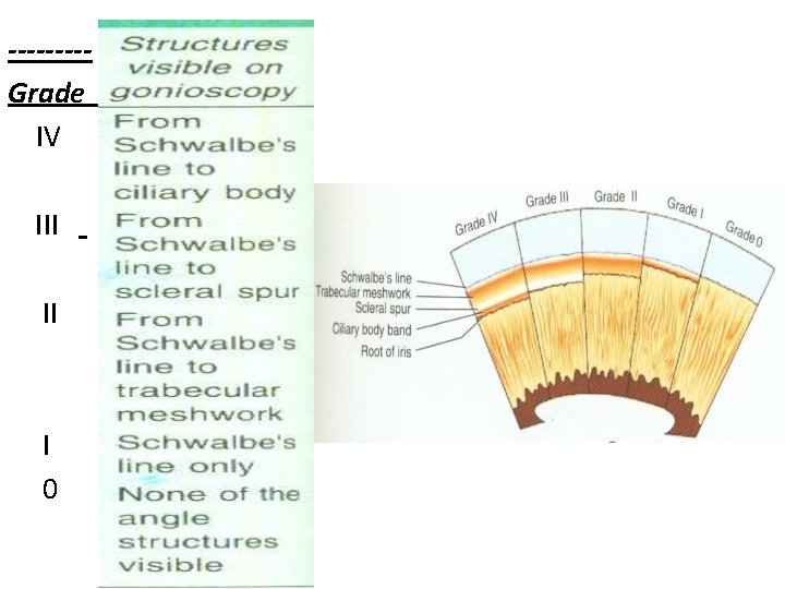 ----Grade IV III II I 0 