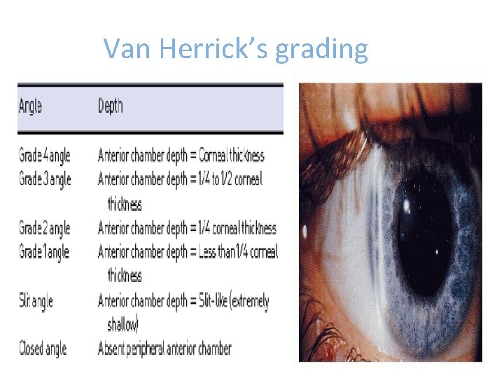 Van Herrick’s grading 