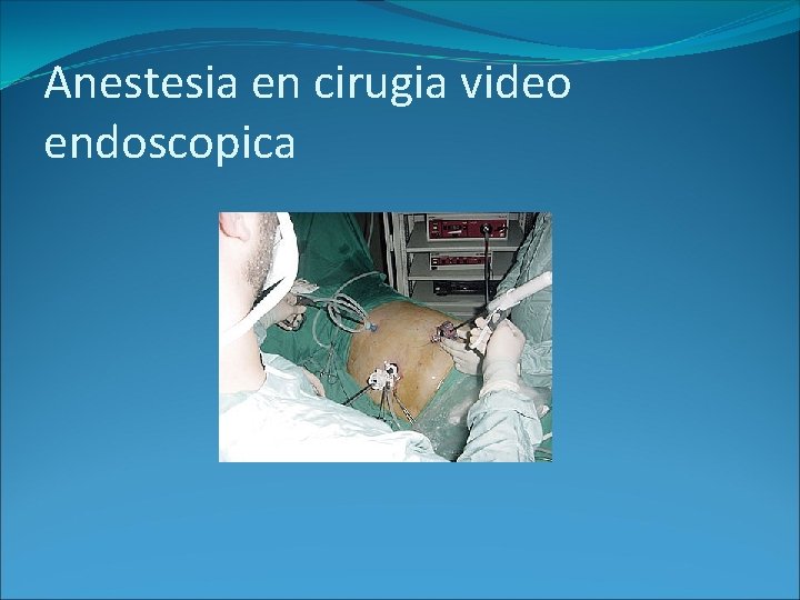 Anestesia en cirugia video endoscopica Anestesia en cirugia video endoscopica
