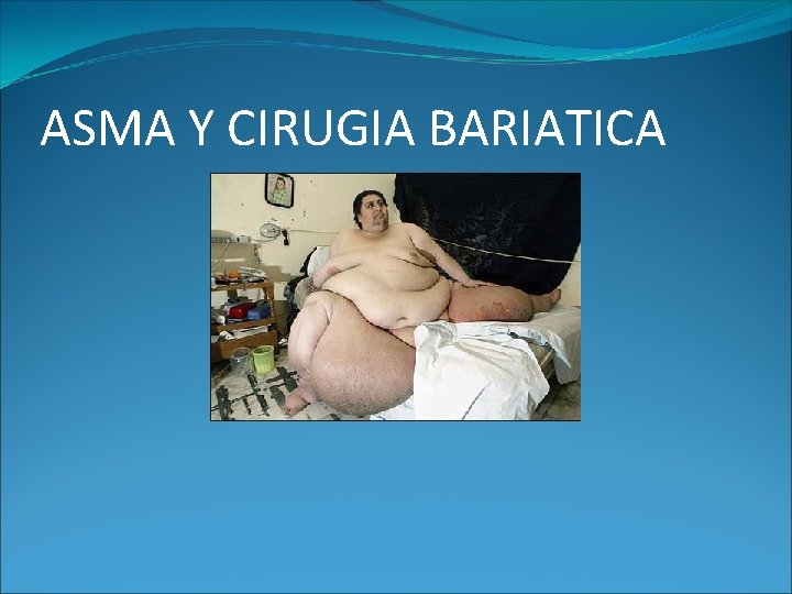 ASMA Y CIRUGIA BARIATICA ASMA Y CIRUGIA BARIATICA