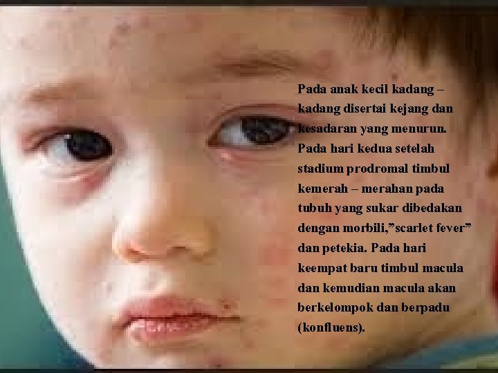 Pada anak kecil kadang – kadang disertai kejang dan kesadaran yang menurun. Pada hari