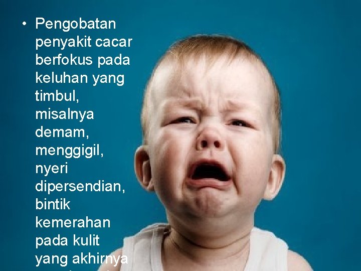  • Pengobatan penyakit cacar berfokus pada keluhan yang timbul, misalnya demam, menggigil, nyeri