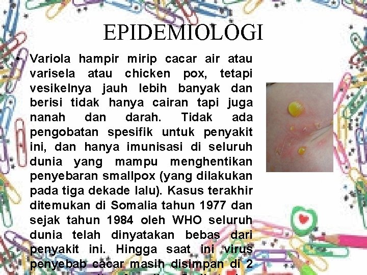 EPIDEMIOLOGI • Variola hampir mirip cacar air atau varisela atau chicken pox, tetapi vesikelnya
