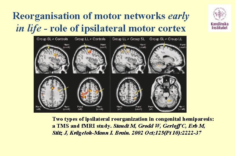 Reorganisation of motor networks early in life - role of ipsilateral motor cortex Two