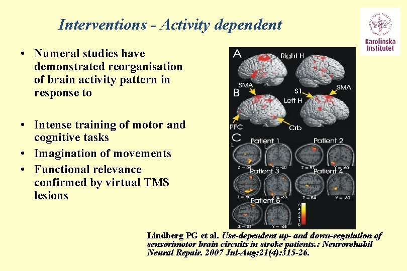 Interventions - Activity dependent • Numeral studies have demonstrated reorganisation of brain activity pattern