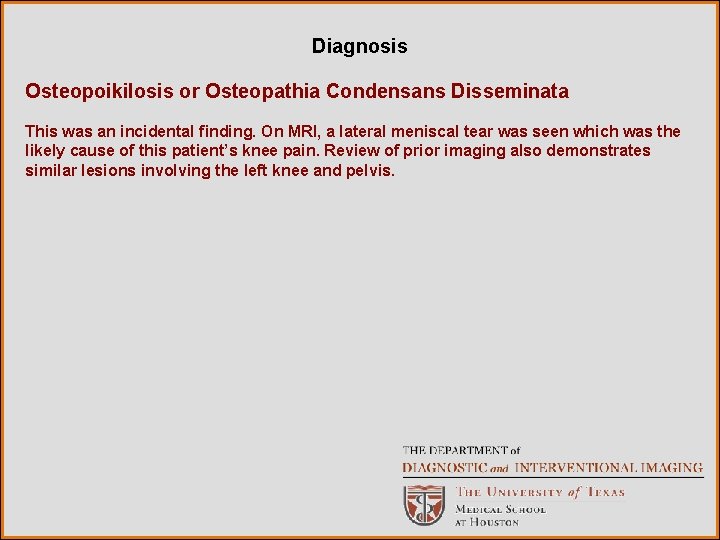 Diagnosis Osteopoikilosis or Osteopathia Condensans Disseminata This was an incidental finding. On MRI, a