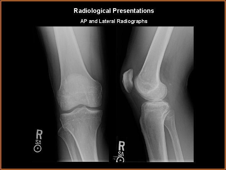 Radiological Presentations AP and Lateral Radiographs 