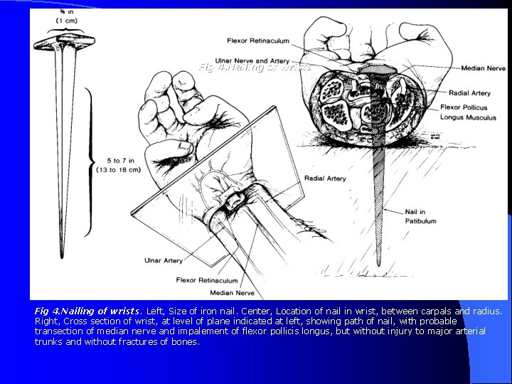 Fig 4. Nailing of wrists. Left, Size of iron nail. Center, Location of nail