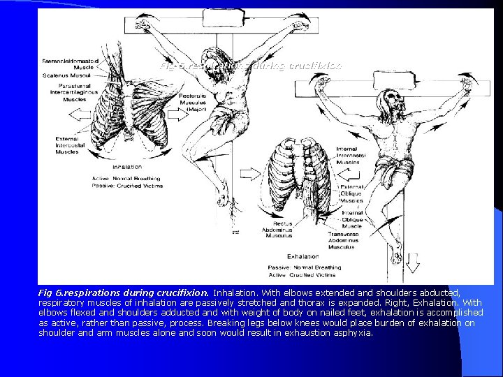 Fig 6. respirations during crucifixion. Inhalation. With elbows extended and shoulders abducted, respiratory muscles