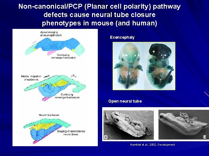 Non-canonical/PCP (Planar cell polarity) pathway defects cause neural tube closure phenotypes in mouse (and
