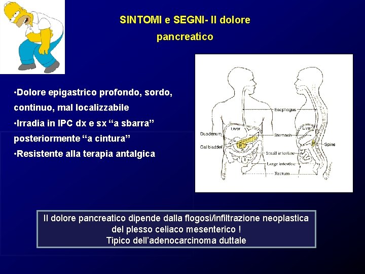 SINTOMI e SEGNI- Il dolore pancreatico • Dolore epigastrico profondo, sordo, continuo, mal localizzabile