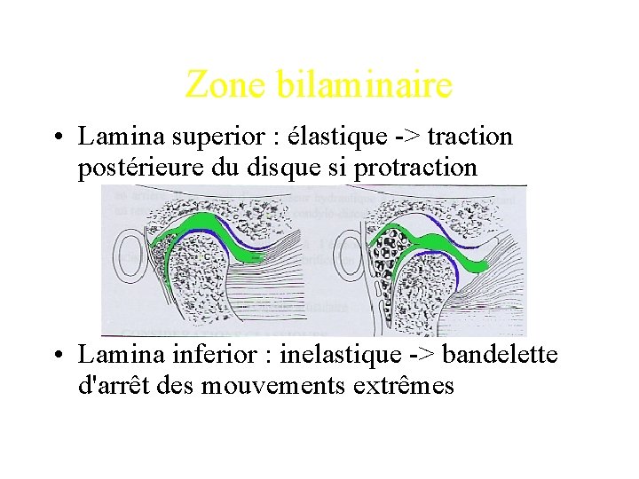 Zone bilaminaire • Lamina superior : élastique -> traction postérieure du disque si protraction