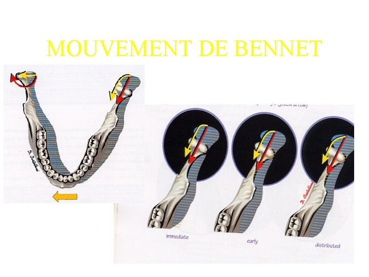 MOUVEMENT DE BENNET 