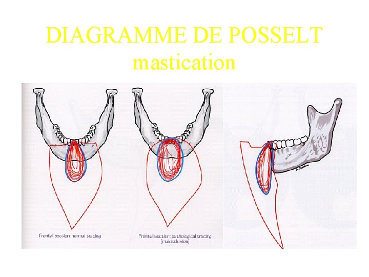 DIAGRAMME DE POSSELT mastication 