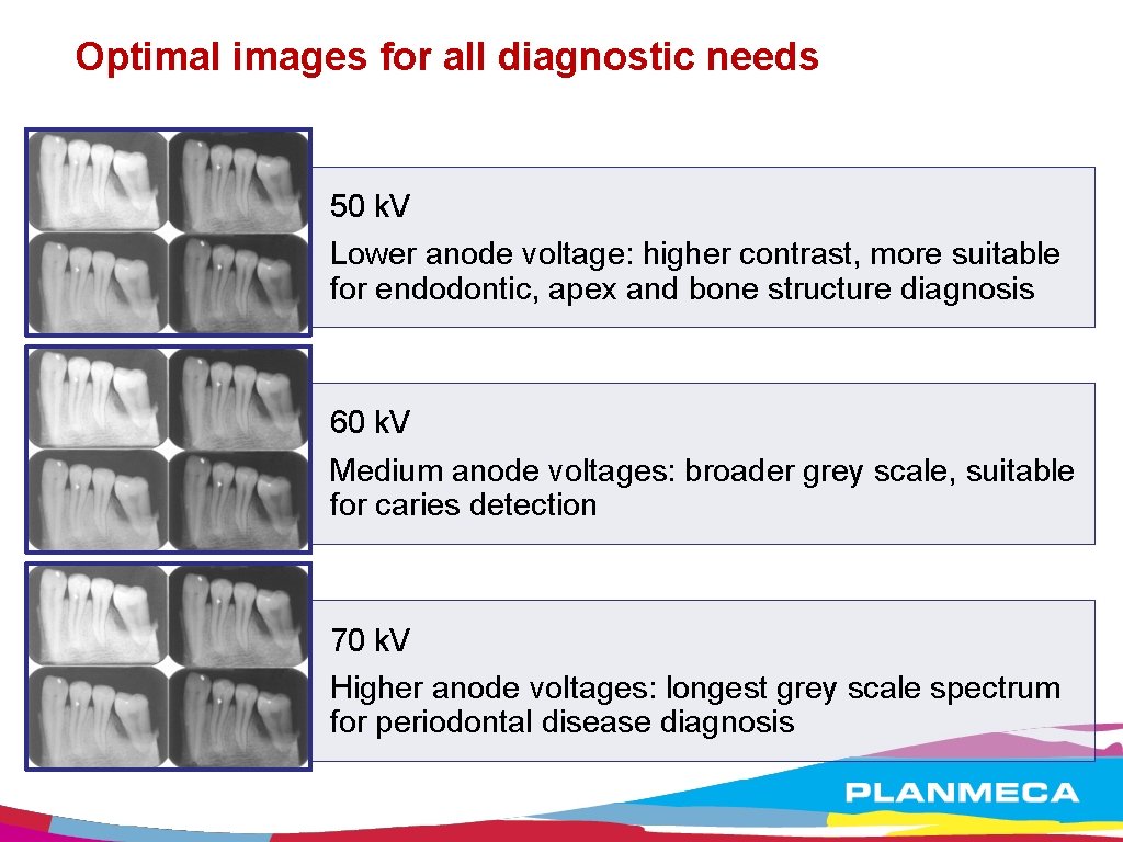 Optimal images for all diagnostic needs 50 k. V Lower anode voltage: higher contrast,