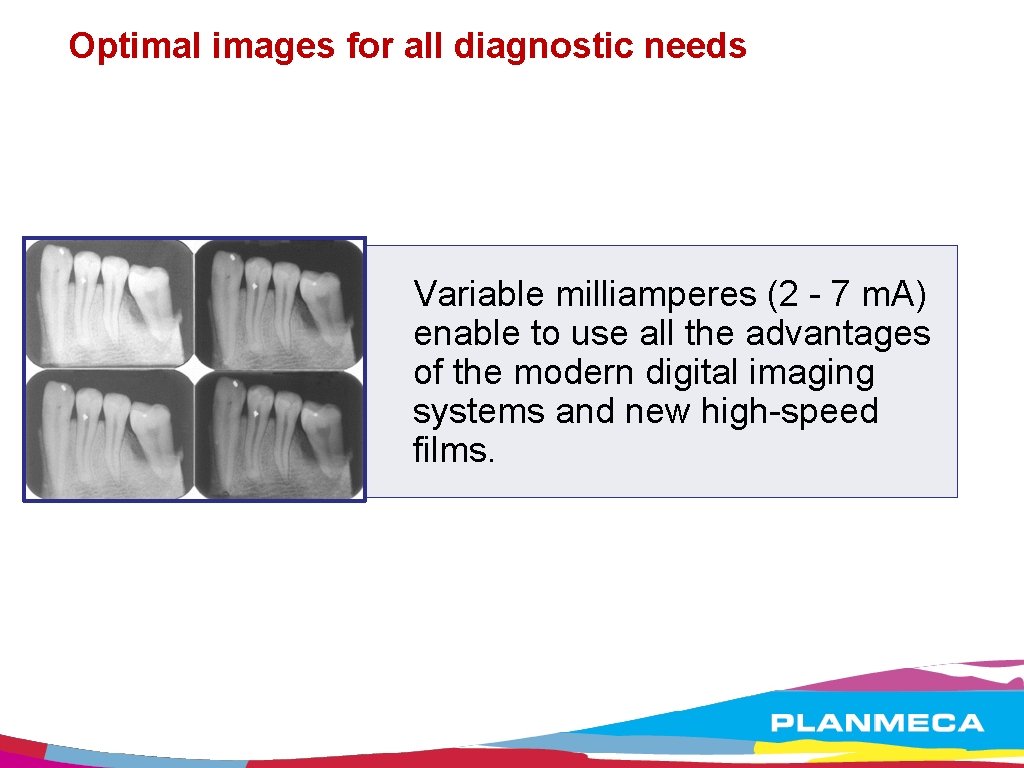 Optimal images for all diagnostic needs Variable milliamperes (2 - 7 m. A) enable