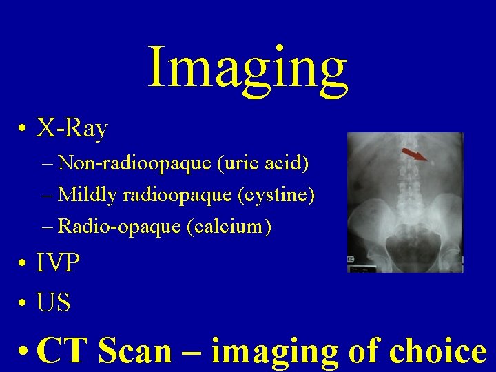 Imaging • X-Ray – Non-radioopaque (uric acid) – Mildly radioopaque (cystine) – Radio-opaque (calcium) Imaging • X-Ray – Non-radioopaque (uric acid) – Mildly radioopaque (cystine) – Radio-opaque (calcium)