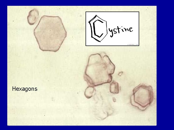 Hexagons Hexagons