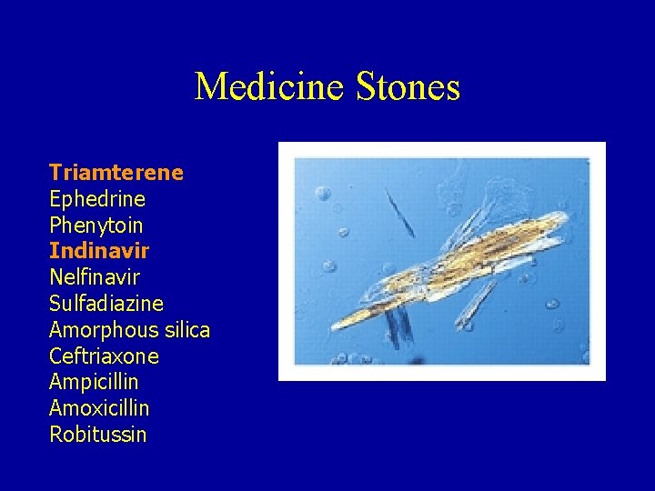 Medicine Stones Triamterene Ephedrine Phenytoin Indinavir Nelfinavir Sulfadiazine Amorphous silica Ceftriaxone Ampicillin Amoxicillin Robitussin Medicine Stones Triamterene Ephedrine Phenytoin Indinavir Nelfinavir Sulfadiazine Amorphous silica Ceftriaxone Ampicillin Amoxicillin Robitussin