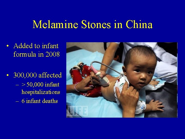 Melamine Stones in China • Added to infant formula in 2008 • 300, 000 Melamine Stones in China • Added to infant formula in 2008 • 300, 000