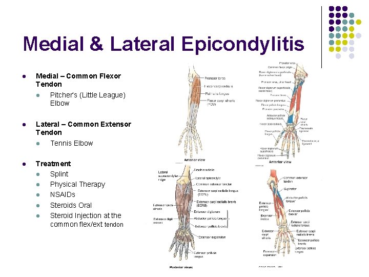 Medial & Lateral Epicondylitis l Medial – Common Flexor Tendon l Pitcher’s (Little League)