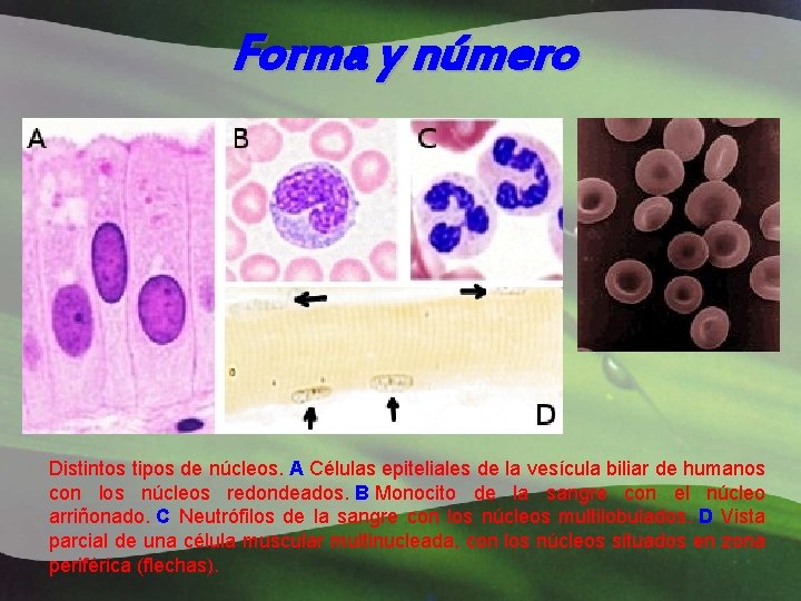 Forma y número Distintos tipos de núcleos. A Células epiteliales de la vesícula biliar