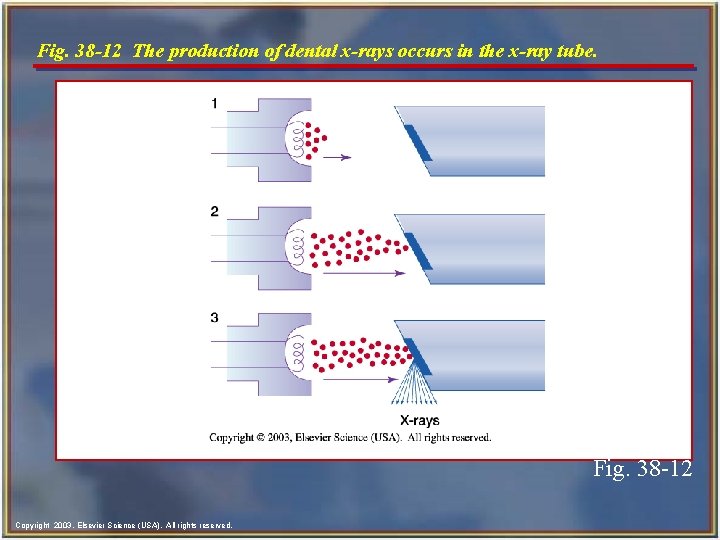 Fig. 38 -12 The production of dental x-rays occurs in the x-ray tube. Fig.