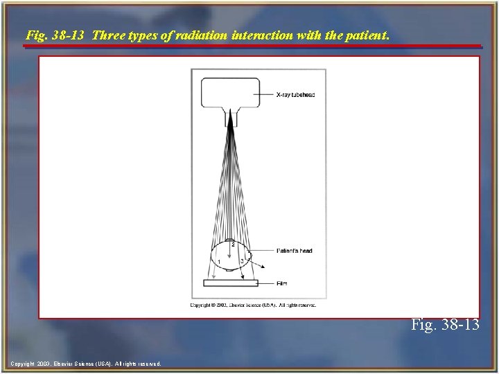 Fig. 38 -13 Three types of radiation interaction with the patient. Fig. 38 -13