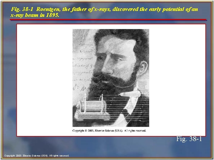 Fig. 38 -1 Roentgen, the father of x-rays, discovered the early potential of an