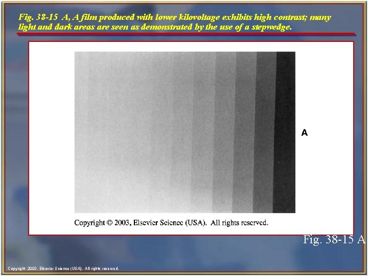 Fig. 38 -15 A, A film produced with lower kilovoltage exhibits high contrast; many