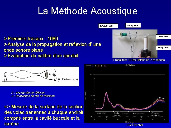 La Méthode Acoustique Embout buccal ØPremiers travaux : 1980 ØAnalyse de la propagation et