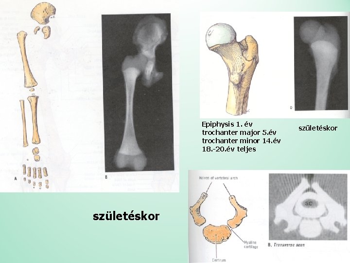 Epiphysis 1. év trochanter major 5. év trochanter minor 14. év 18. -20. év