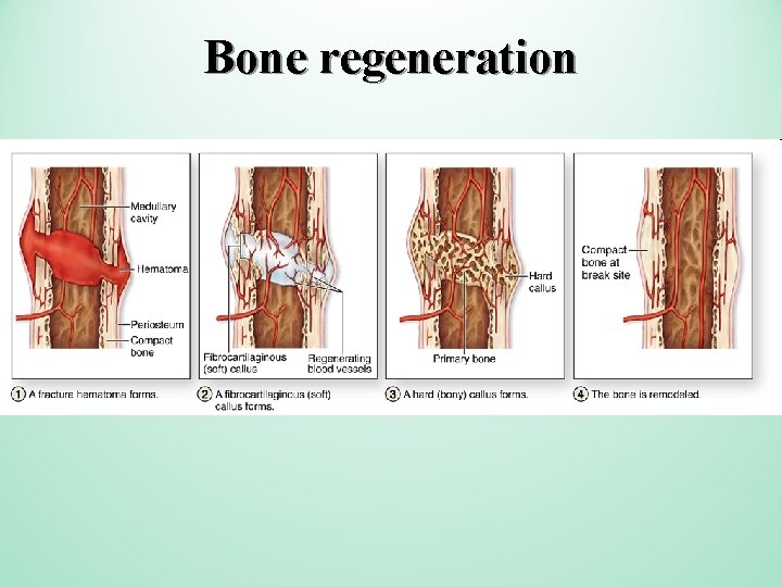 Bone regeneration 