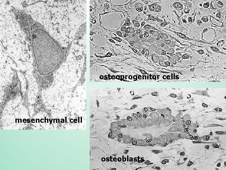 osteoprogenitor cells mesenchymal cell osteoblasts 