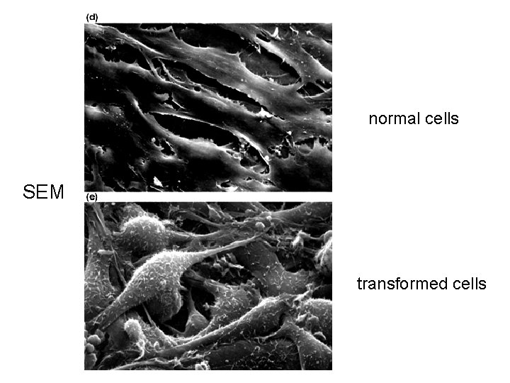 normal cells SEM transformed cells 
