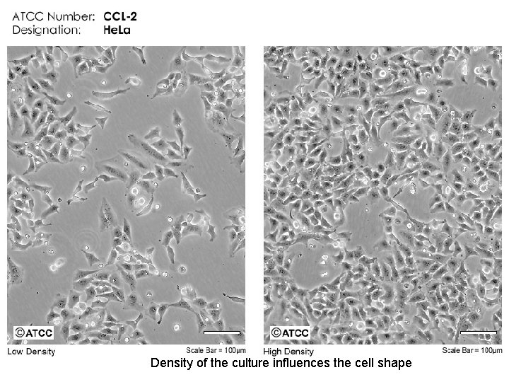 Density of the culture influences the cell shape 