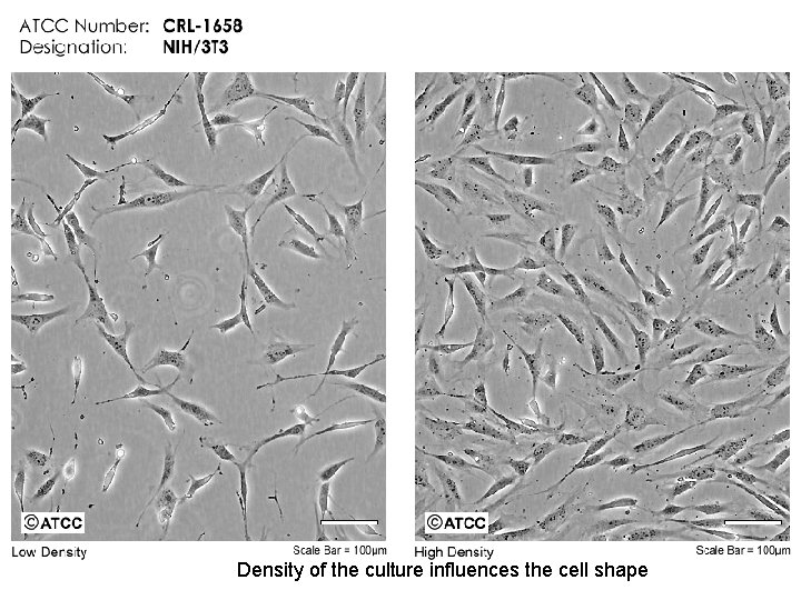 Density of the culture influences the cell shape 