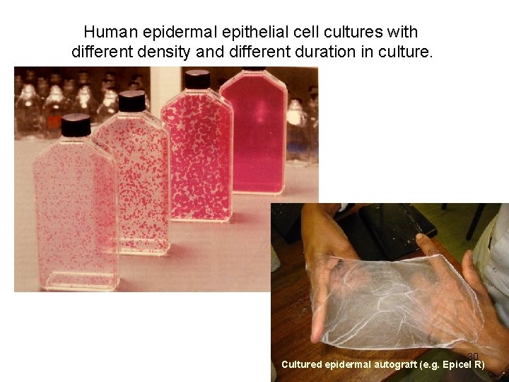 Human epidermal epithelial cell cultures with different density and different duration in culture. 30