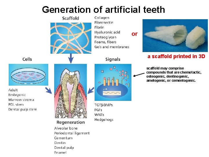 Generation of artificial teeth or a scaffold printed in 3 D scaffold may comprise