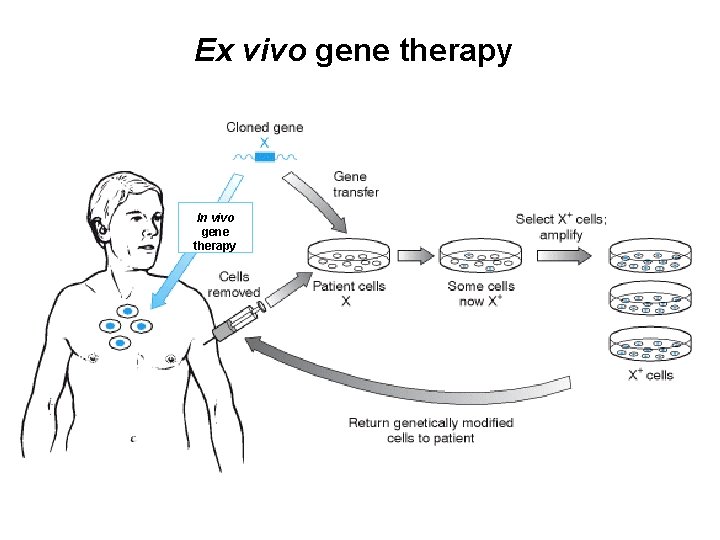 Ex vivo gene therapy In vivo gene therapy 