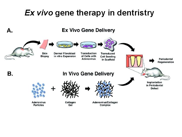 Ex vivo gene therapy in dentristry 