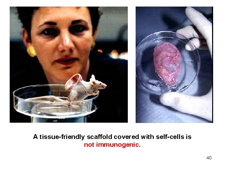 A tissue-friendly scaffold covered with self-cells is not immunogenic. 40 