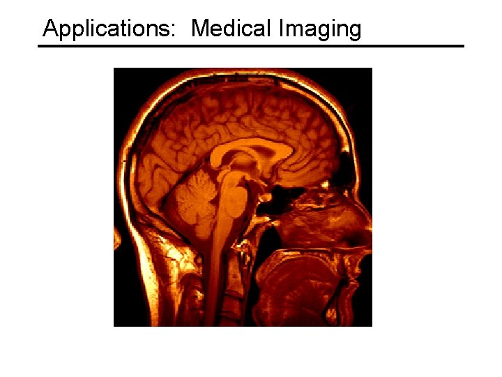 Applications: Medical Imaging 